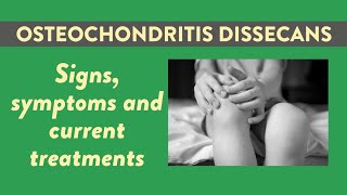 Osteochondritis dissecans OCD Signs symptoms and current treatments [upl. by Frasquito597]