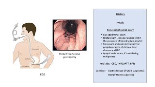 An Approach to GI Bleeding Melena Hematemesis Hematochezia [upl. by Alyahc]