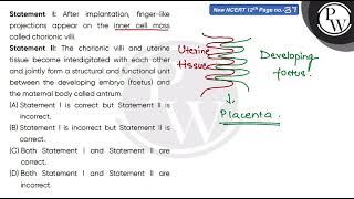 Statement I After implantation fingerlike projections appear on the inner cell mass called ch [upl. by Lairea]