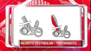 NEURITIS VESTIBULAR TRATAMIENTO [upl. by Leandro187]