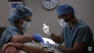 Mayo Clinic Minute How Mohs surgery is used to fight skin cancer [upl. by Stoll]