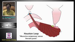 Lecture 4 on male urethrography [upl. by Ertnod511]