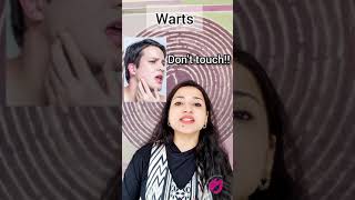 How To Get Rid Of warts On Neck Face body  MBBS MD MAMC SKIN HINDI 2021 [upl. by Norbel]