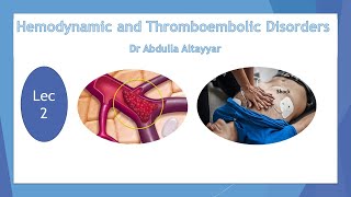 Hemodynamic Disorders and Thromboembolic Disease Lecture2 محاضرة أمراض قلبية متعددة [upl. by Adrea]