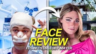 Facial Feminization Surgery with Dr Toby Mayer [upl. by Janyte]