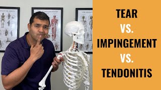 Rotator Cuff Tear VS Shoulder Impingement VS Shoulder Tendonitis [upl. by Nomit]