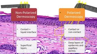 Principles of Dermoscopy  Dr Natalia Jaimes [upl. by Puglia191]