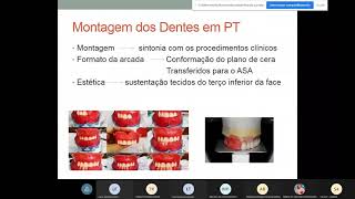 Aula 7 220421  Montagem dos Dentes Ceroplastia e Acrilização da Prótese Total [upl. by Hagi675]