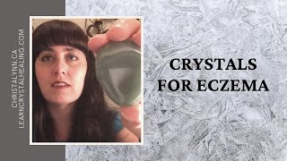 Crystals for Eczema [upl. by Frances]