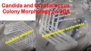 Candida and Cryptococcus colony morphology on SDA [upl. by Akehsay]