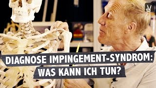 Impingement Syndrom  was ist passiert und was kann ich tun Professor Froböse klärt auf [upl. by Amara]