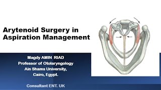 Arytenoid Surgery in Aspiration Management [upl. by Venus]