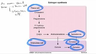 USMLE S2CK Uworld Gynae case 20  Granulosa cell tumor [upl. by Abdul605]