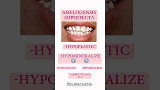 AMELOGENESIS IMPERFECTA dental anomalies enameldefects imperfecta [upl. by Anival]