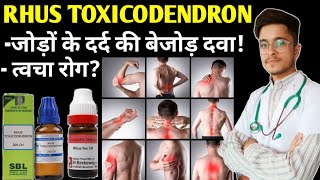 Rhus Tox 200 Homeopathic Medicine uses  Rhus Toxicodendron 30 uses in Hindi [upl. by Hiroko]