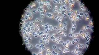 Bloedgroep géén agglutinatie microscopisch fasecontrast [upl. by Adnamaa]