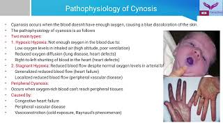 General Examination Cyanosis  Recognizing the Blue Tint  A Guide to Clinical Examination [upl. by Brick]