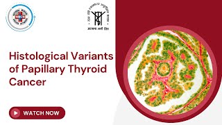 Histological Variants of Papillary Thyroid Cancer [upl. by Waters23]