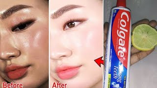 Colgate toothpaste for face whitening  Lemon and Colgate [upl. by Atnauqal]