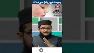 Chehray Ke Rashes Ka Ailaj  Farhan Siddique [upl. by Zealand]