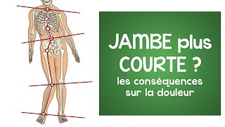 Jambe plus courte  les conséquences saisissantes sur la douleur [upl. by Anne319]