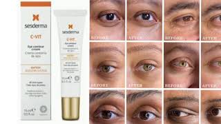 Sesderma CVIT Eye Contour Cream [upl. by Niarb408]