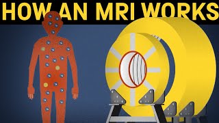 How does an MRI machine work [upl. by Bozovich]