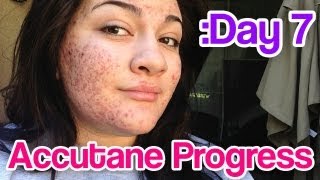 Day 7 Accutane SEVERE Acne Update [upl. by Zoi]