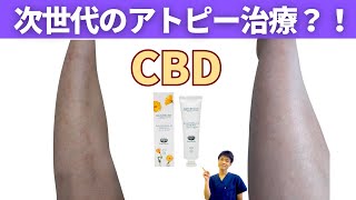 【最新治療】CBD製品がアトピーに良いか実際に使ってみてもらった結果… [upl. by Kcirddehs]