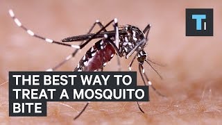 The best way to treat a mosquito bite [upl. by Risser309]