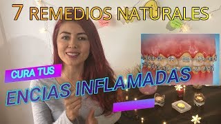 COMO CURAR ENCIAS INFLAMADAS REMEDIOS CASEROS PARA ENCIAS INFLAMADAS TRATAMIENTO PARA ENCIAS [upl. by Dnomar]