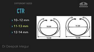 Capsule tension ring CTR Back To Basics  Intro PART 1 Dr Deepak Megur [upl. by Ahsitel]