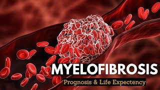 Myelofibrosis Explained What You Need to Know [upl. by Paynter]