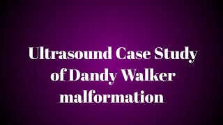 Ultrasound case study of Dandy walker malformation [upl. by Fritz]