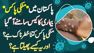 Pakistan Me Monkeypox Virus Ka Case Samne Aa Gia  Monkeypox Virus Kitna Dangerous Or Kese Phelta Ha [upl. by Arob]