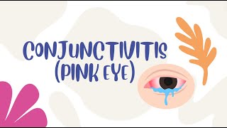 How to treat conjunctivitis pink eye [upl. by Nodnal]