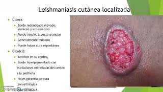 Leishmaniasis3 [upl. by Nofets]