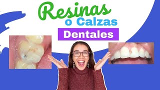 Calzas o resinas dentales ¿cómo las hace mi odontólogo [upl. by Halsted234]