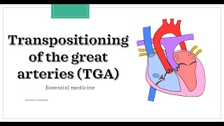 What is Transposition of the Great Arteries [upl. by Thais658]