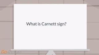 What is the Carnett sign [upl. by Nirrep]