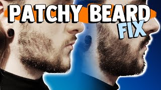 HOW TO FIX A PATCHY BEARD  6 Methods to fix your patchy beard [upl. by Naamann708]