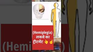 Hemiplegia लकवे का ट्रीटमेंटparalysis physiotherapy chiropractor pain viralvideo [upl. by Yelsel]