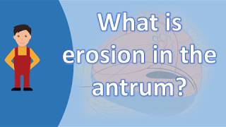 What is erosion in the antrum   Best and Top Health FAQs [upl. by Justicz]