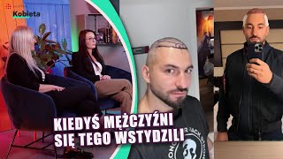 Polacy masowo przeszczepiają włosy w Turcji Dlaczego „Wynika to z ich niewiedzy” MAMY CZAS [upl. by Elda]