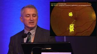 EuretinaESCRS 2015  Treatment of Chronic Central Serous Chorioretinopathy [upl. by Ennasor]