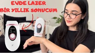 XIAOMI İNFACE İPL 1 YILLIK SONUCUM evdelazer [upl. by Marv]