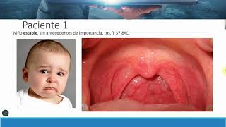 Emergencia Pediatricas Parte 1 [upl. by Jempty847]