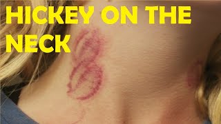 how to give someone a hickey on the neck fast trick [upl. by Ammamaria]