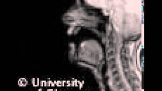 MRI voiced palatal lateralapproximant [upl. by Nguyen]