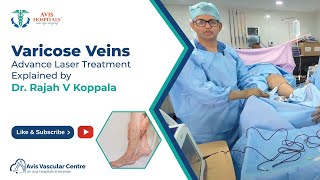 Varicose Veins Advance Laser Treatment Explained by Dr Rajah V Koppala  Avis Hospitals [upl. by Itnava]